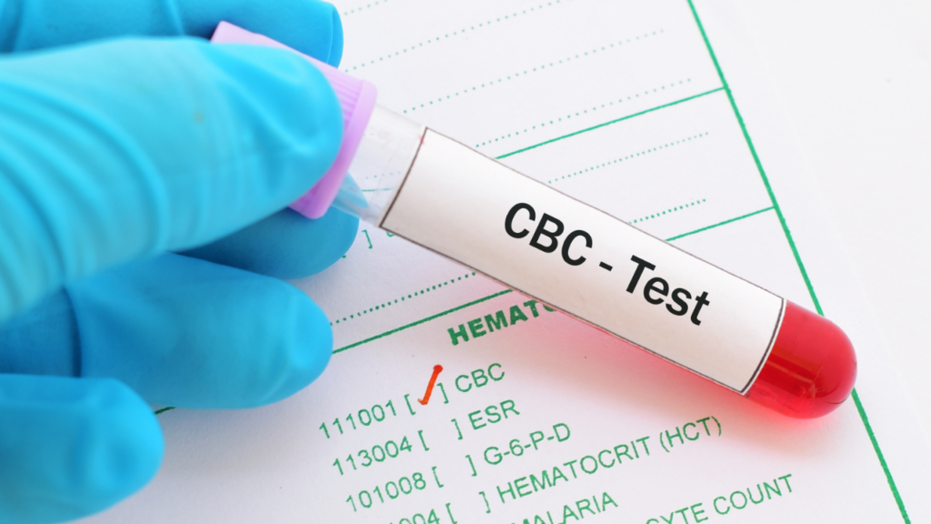 CBC test